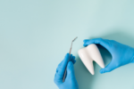 Expert Advice on Maintaining Your Dental Fillings