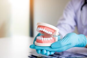 few-things-about-dentures