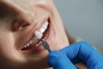 a woman is getting dental bridges treatment