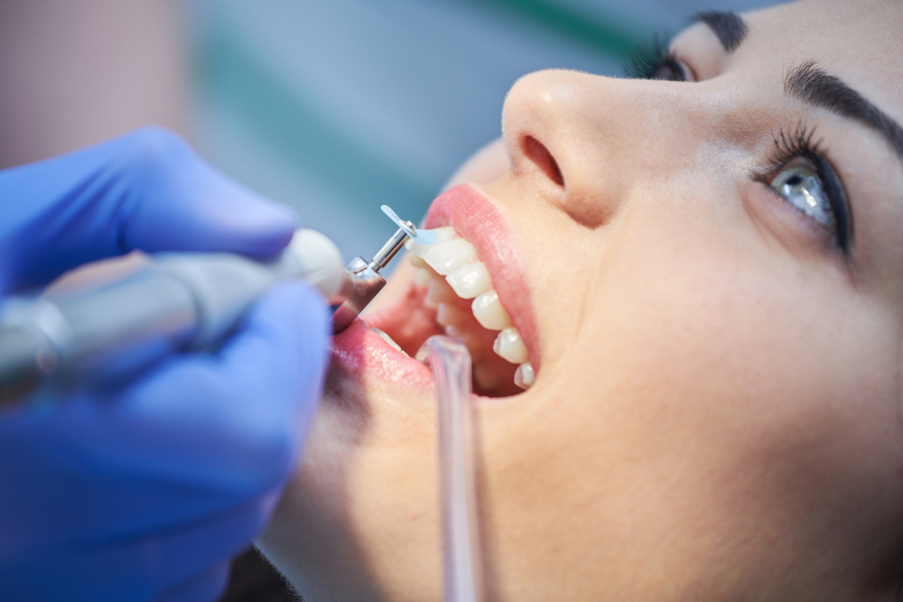 Few Things About Dental Cleanings