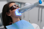 how long does it take for a dentist to professionally whiten teeth