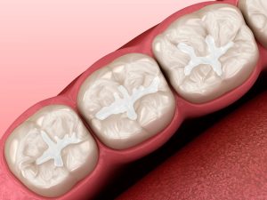 dentist in edmonton